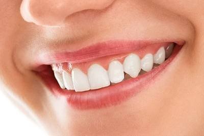 Smile Makeover & Cosmetic Dentistry in Noida